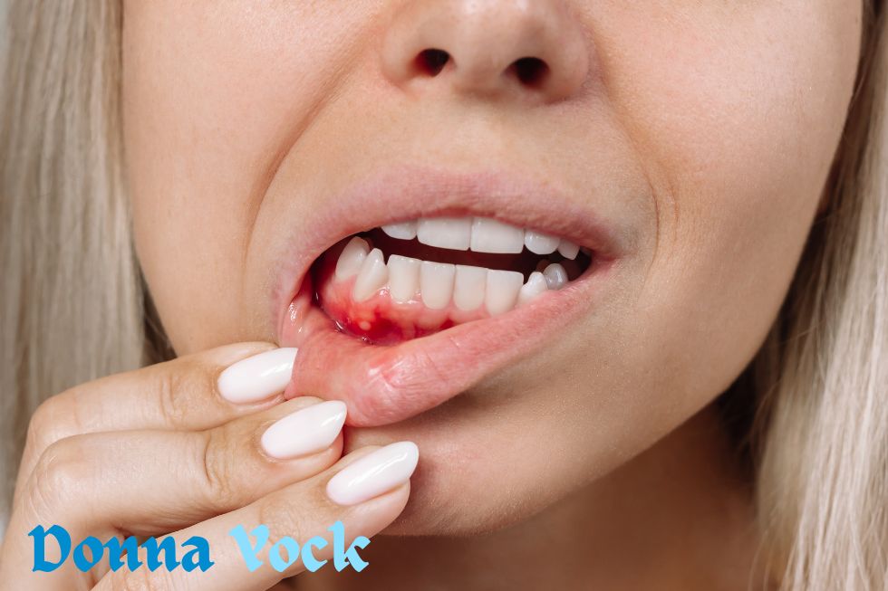 What Causes Receding Gums?