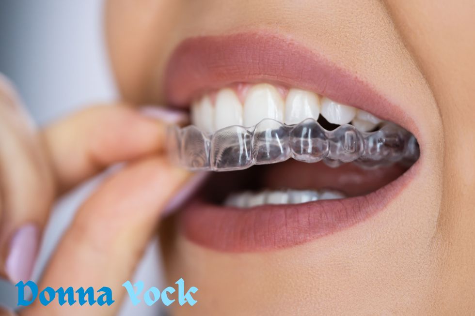 A mouthguard