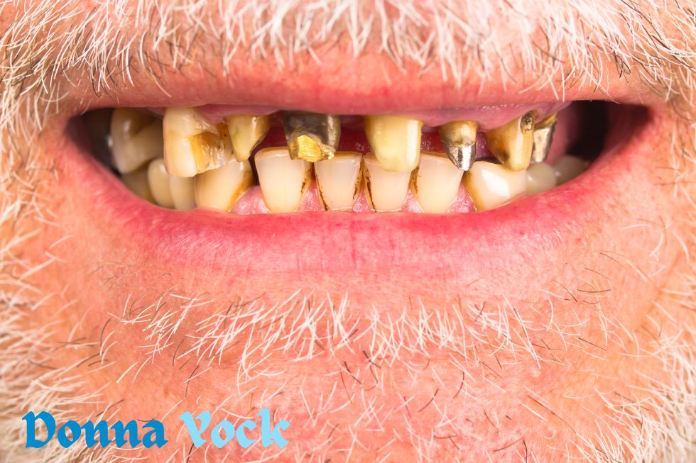 There are six bad habits that affect your teeth, along with ways to prevent them.