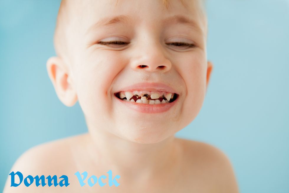 What leads to tooth decay in baby bottles?