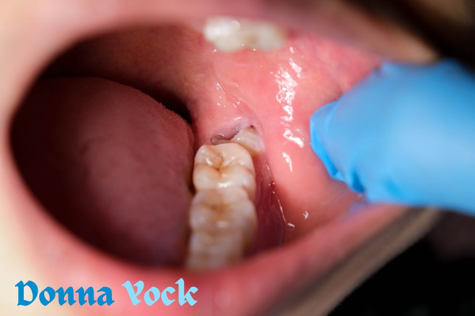 Recognizing the Causes and Treatments of Tooth Sensitivity
