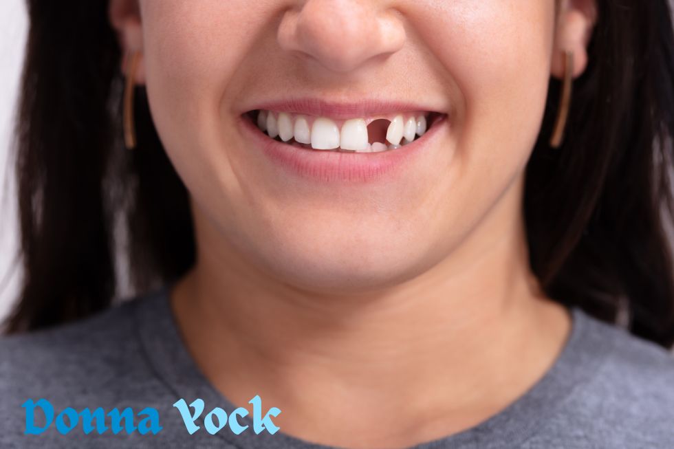 Which Tooth Replacement Options Are Best for Missing Teeth?