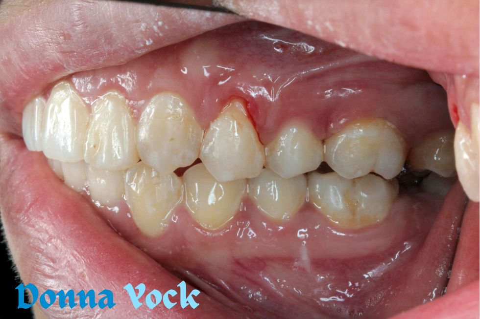 Which Treatment Is Most Effective for Periodontal Disease?