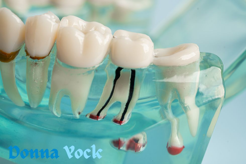 Procedure, Length, and Definition of Root Canals