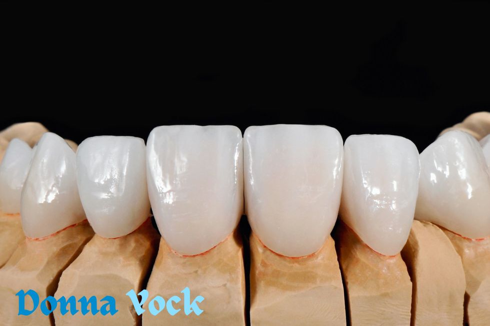 The Top 4 Causes of Dental Veneers in Children